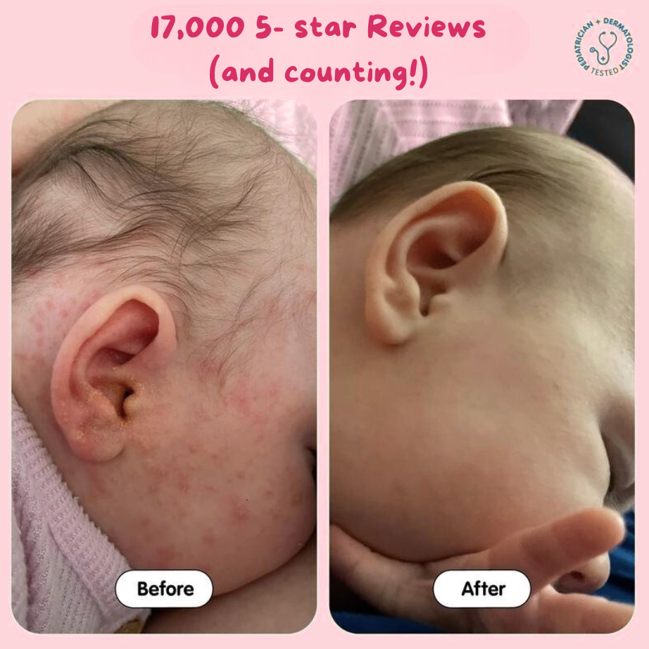 Eczema Beef Tallow Balm -