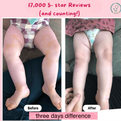 Eczema Beef Tallow Balm